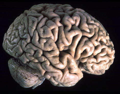 Brain